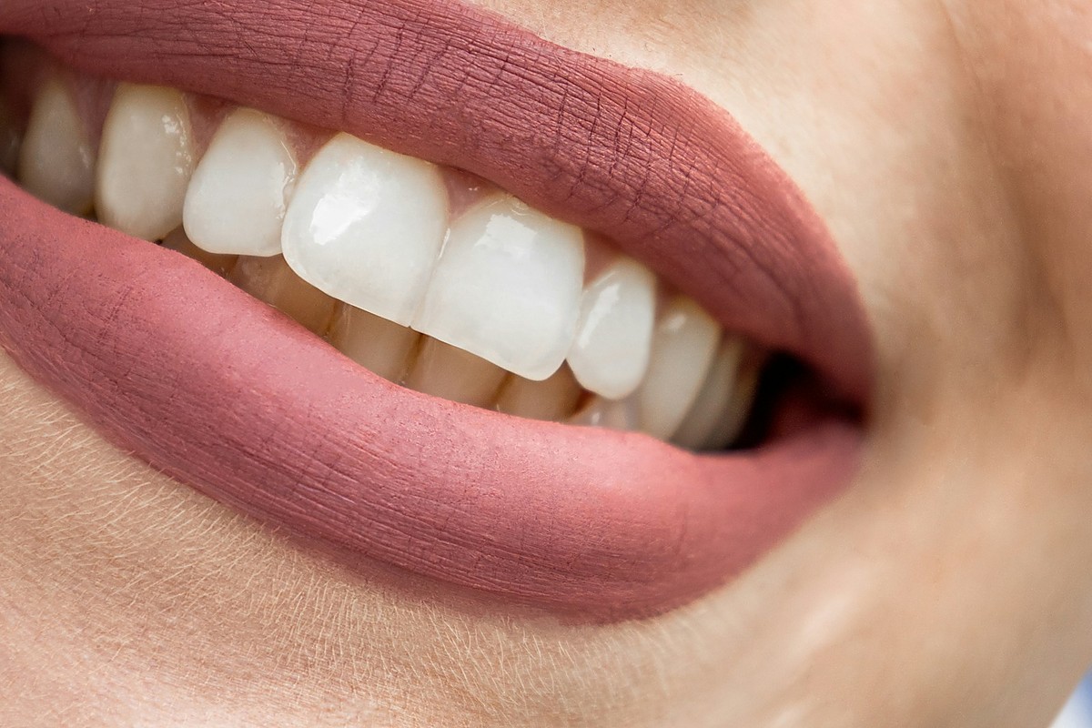 Cosmetic dentistry smile makeover at Dental Dew in Rohini, Delhi